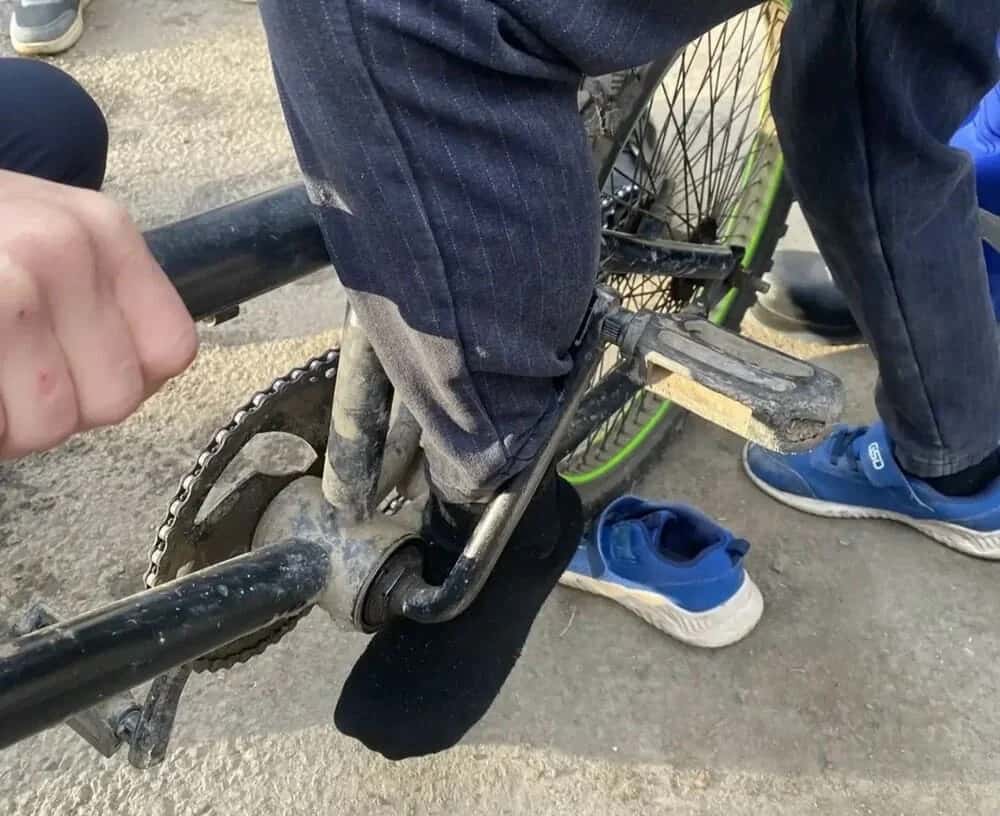 Велосипед «зажевал» ногу подростка в Нижнем Тагиле: фото 