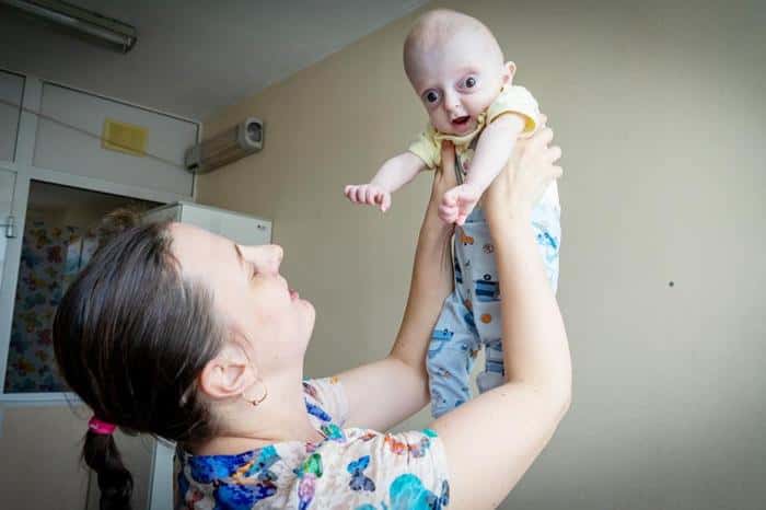 В Свердловской области после тяжелых родов на свет появился малыш с необычной внешностью