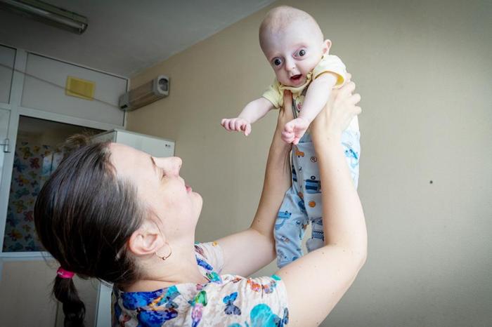 В Свердловской области после тяжелых родов на свет появился малыш с необычной внешностью | На Урале родился мальчик с синдромом Крузона