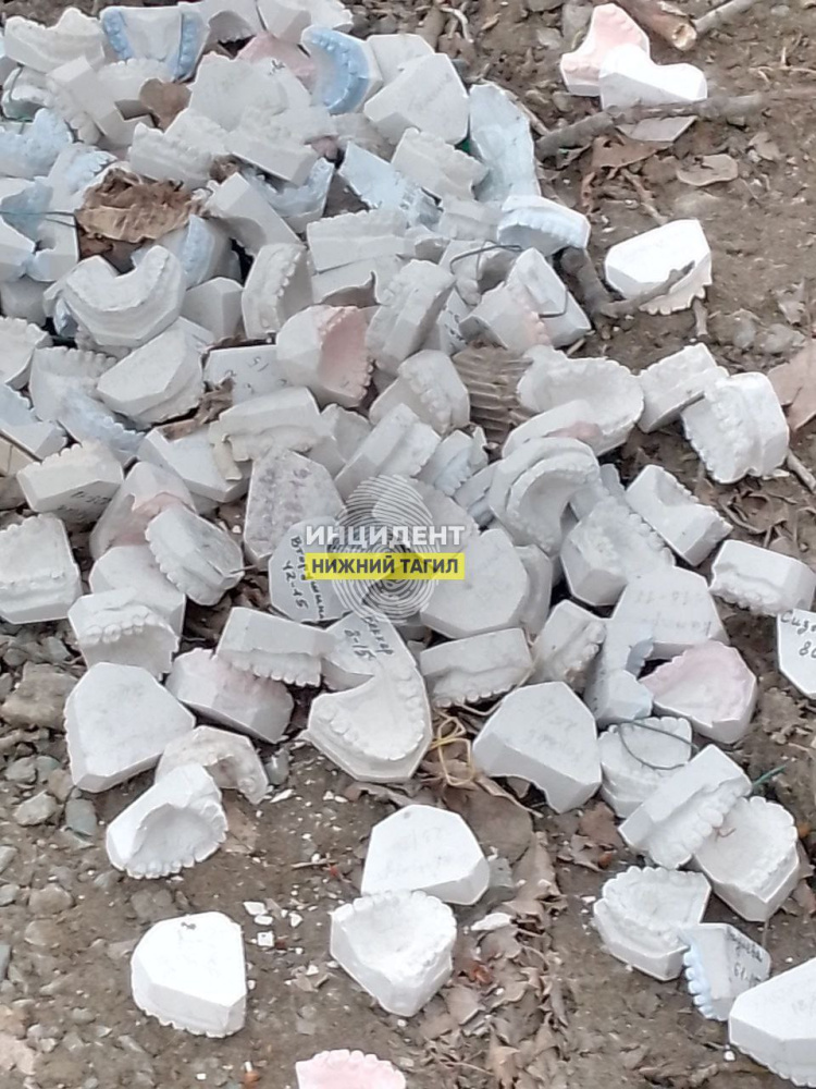  Сотни гипсовых слепков зубов с именами пациентов вывалили возле стоматологии в Нижнем Тагиле | Сотни слепков челюстей с данными пациентов вывалили возле клиники в Свердловской области