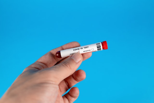 На Среднем Урале выявлено еще 264 случая COVID-19. + 52 в Тагиле