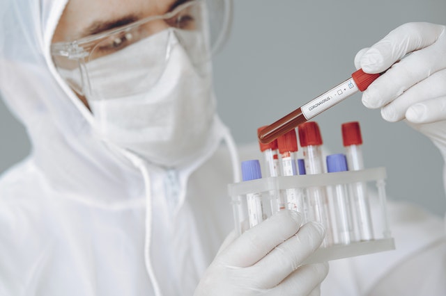 На Среднем Урале выявлено 109 новых случаев COVID-19. + 2 в Тагиле