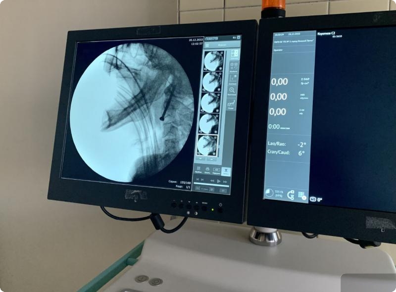 Медики объявили о спасении двух тагильчан с тяжелейшими переломами