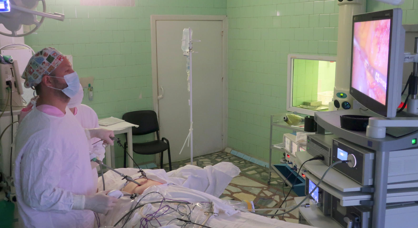 Врачи Свердловской областной клинической больницы №1 впервые реконструировали пищевод из желудка малотравматичным методом 