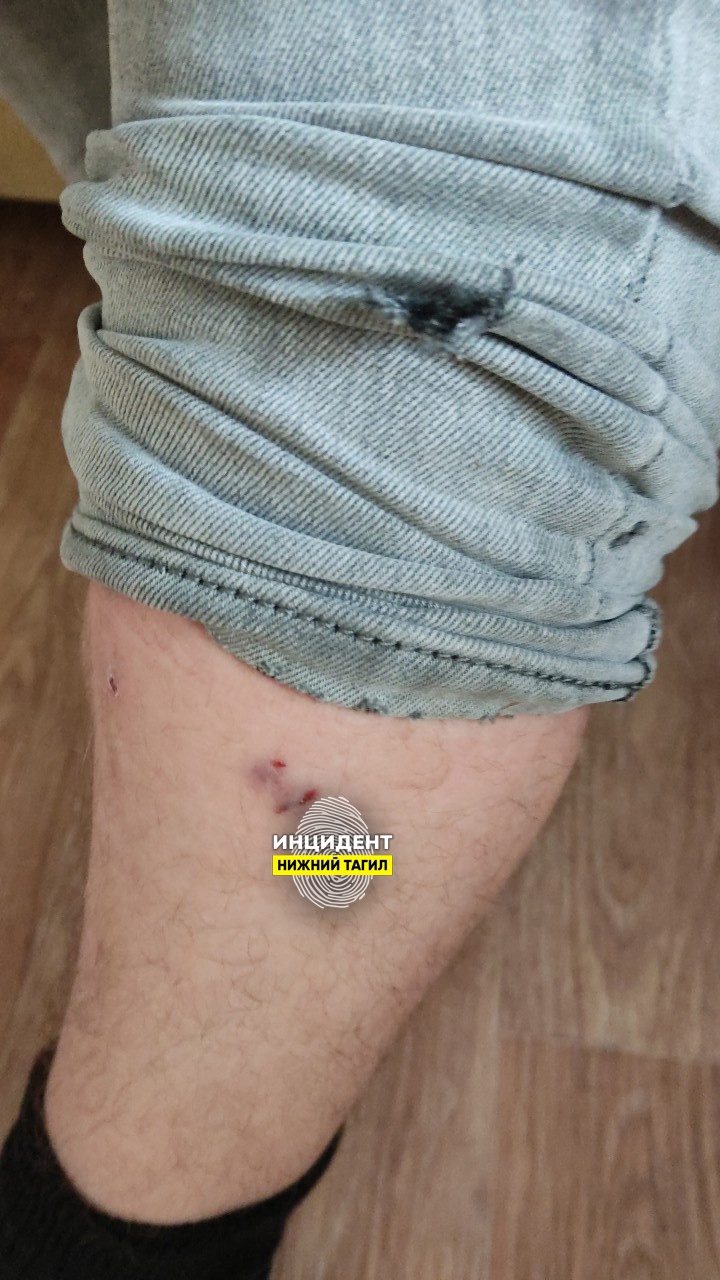 В Нижнем Тагиле стая бездомных собак напала на прохожего