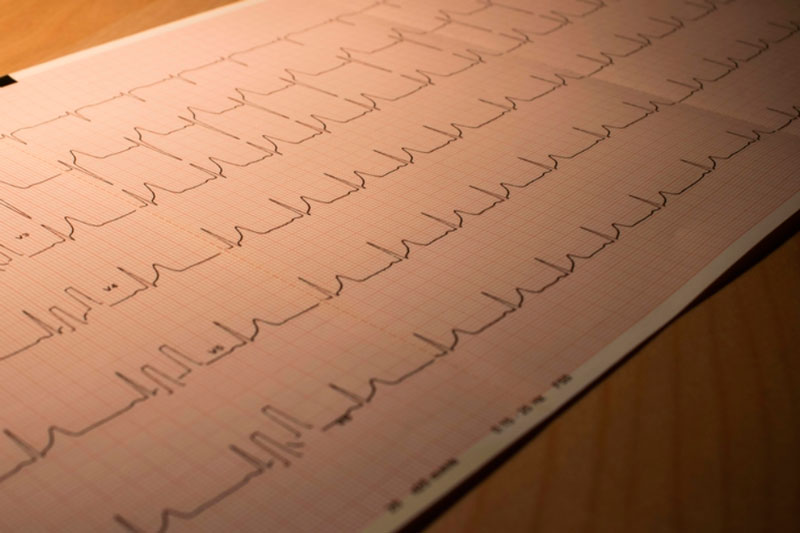 Врач-кардиолог перечислила неочевидные симптомы сердечно-сосудистых заболеваний | Врач-кардиолог Мунхоева: боль в горле, изменение кожи и ногтей могут говорить о проблемах с сердцем