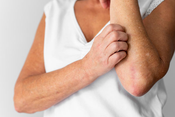 Синдром «рука-нога-рот»: инфекционист Томилин о симптомах вируса Коксаки | Врач Томилин рассказал о симптомах вируса Коксаки