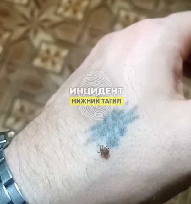 Необычное явление: в самый разгар зимы проснулись клещи в Нижнем Тагиле