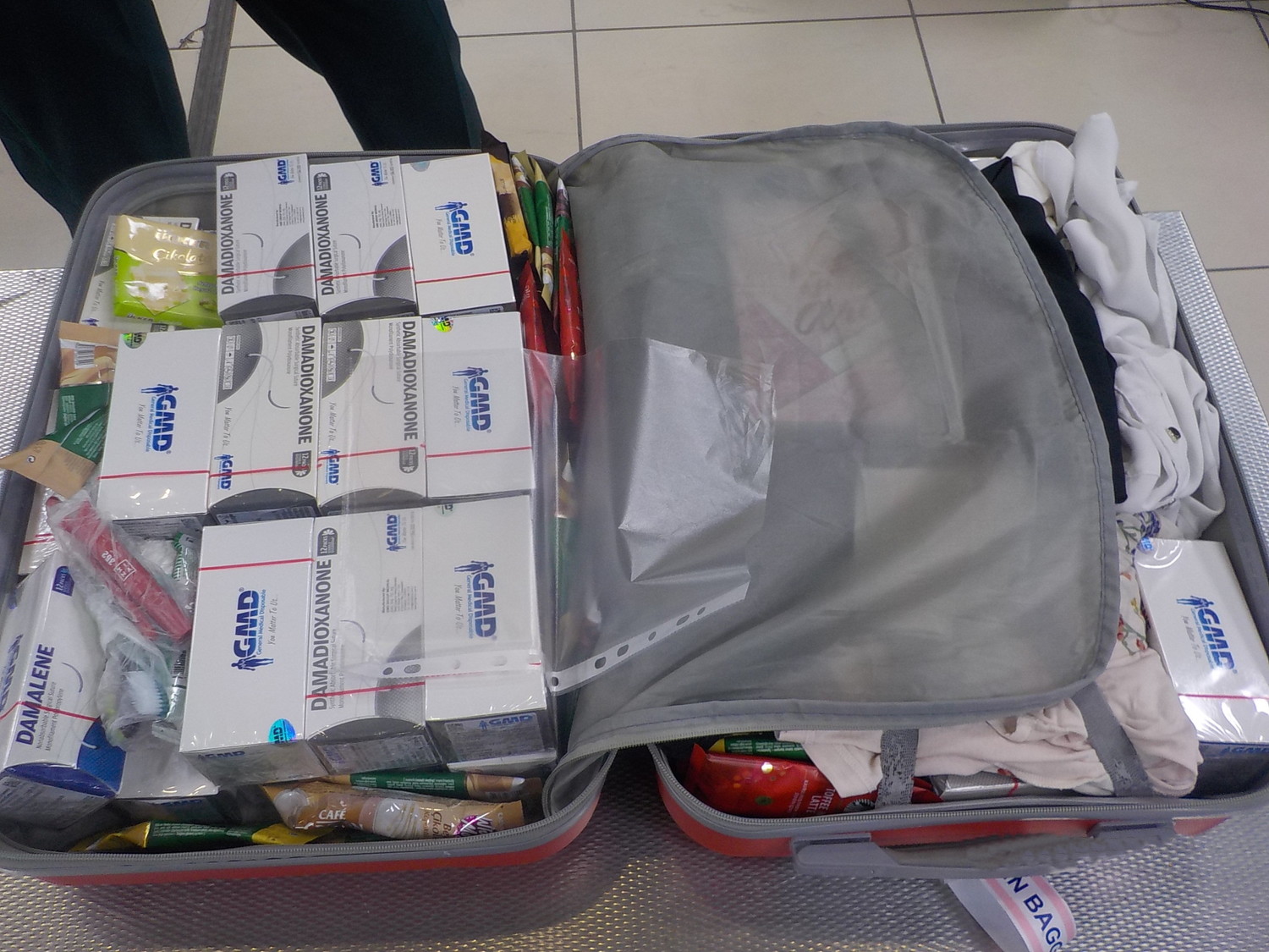 Хирургические нити в багаже. Кольцовские таможенники задержали партию незадекларированных товаров из Стамбула