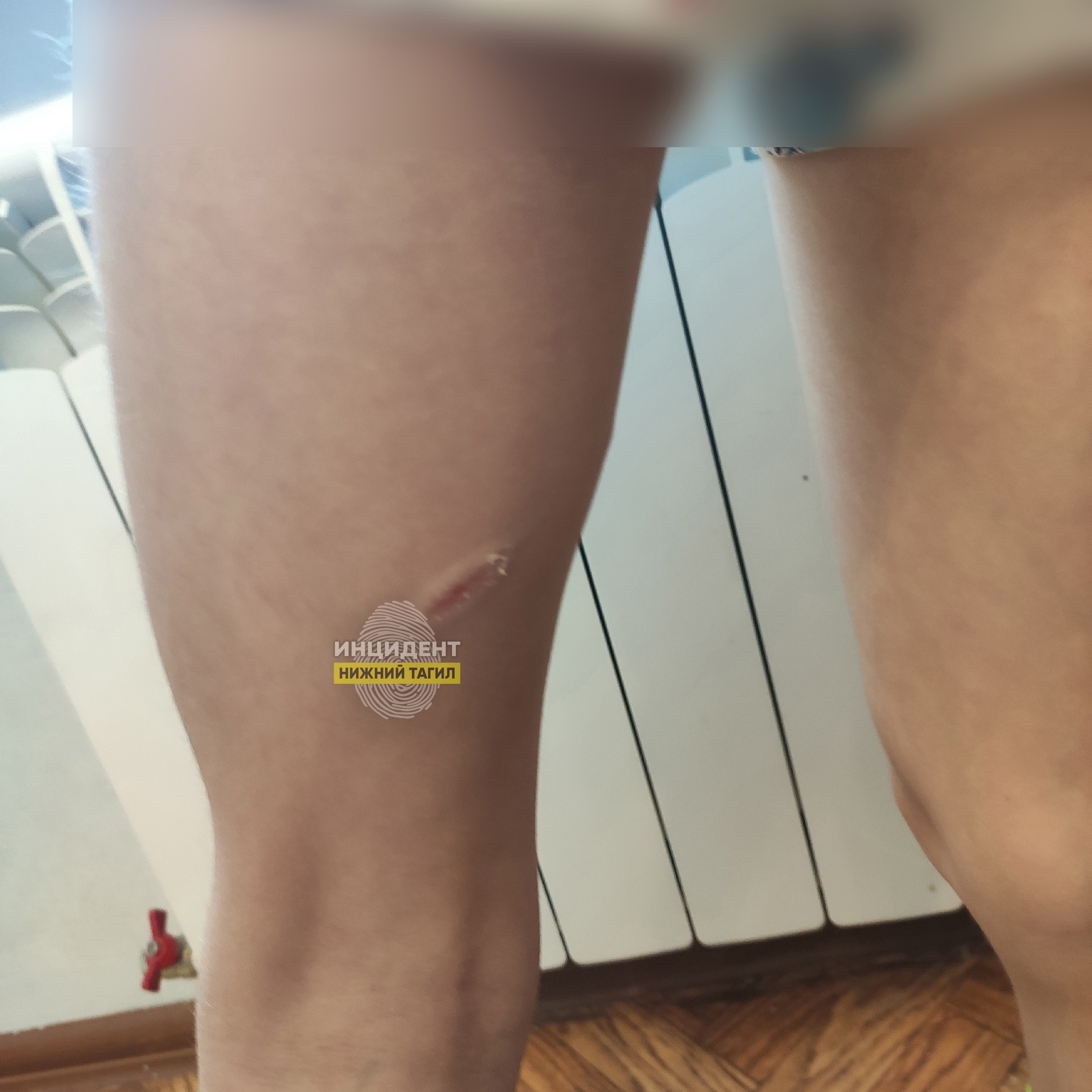 Стая бездомных собак покусала ребёнка в центре Нижнего Тагила