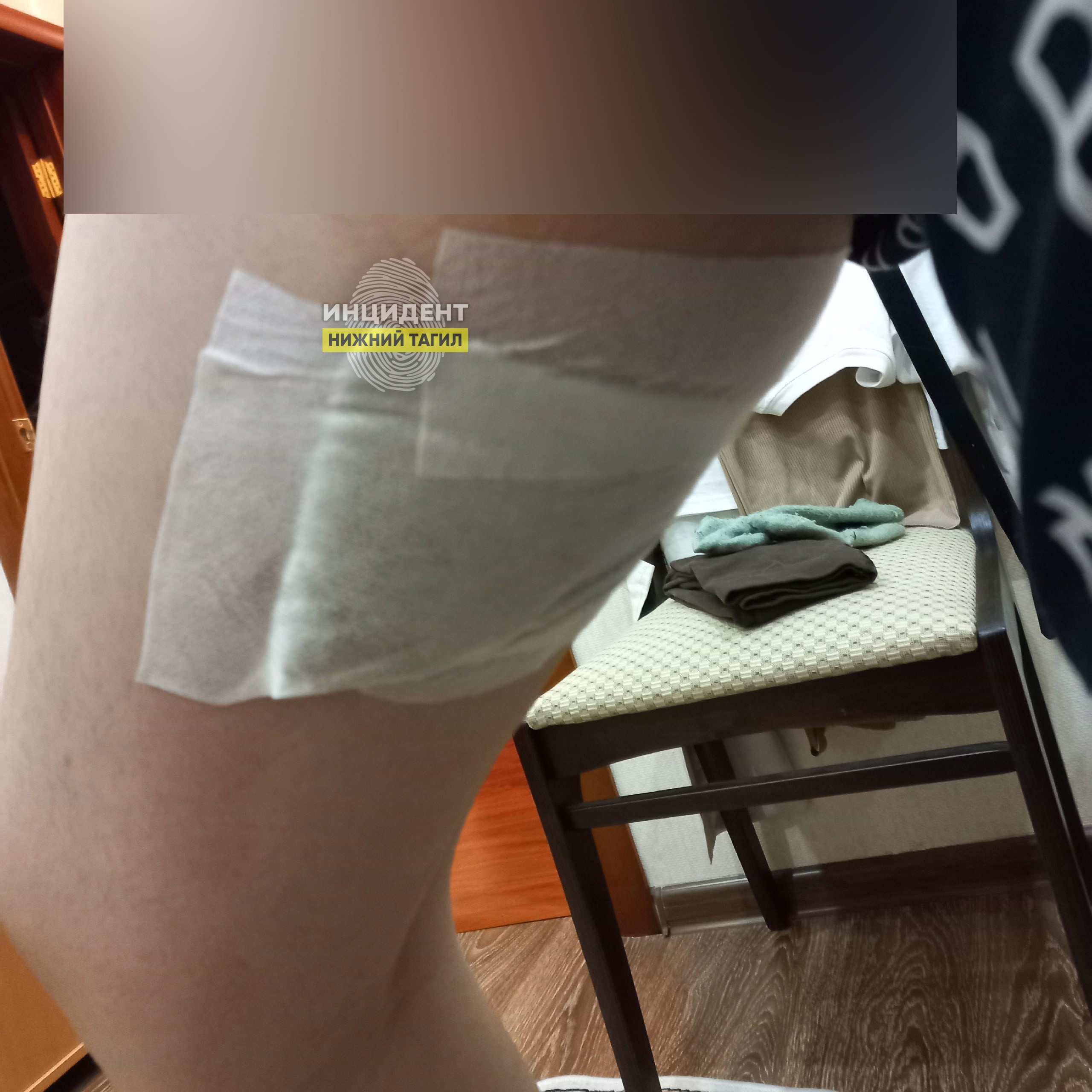 Собака напала на девочку в Нижнем Тагиле