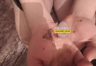 Бастрыкин поручил возбудить уголовное дело по нападению собаки на ребенка-инвалида в Нижнем Тагиле | На Урале поручили возбудить уголовное дело после нападения собаки